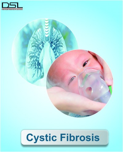 CYSTIC FIBROSIS