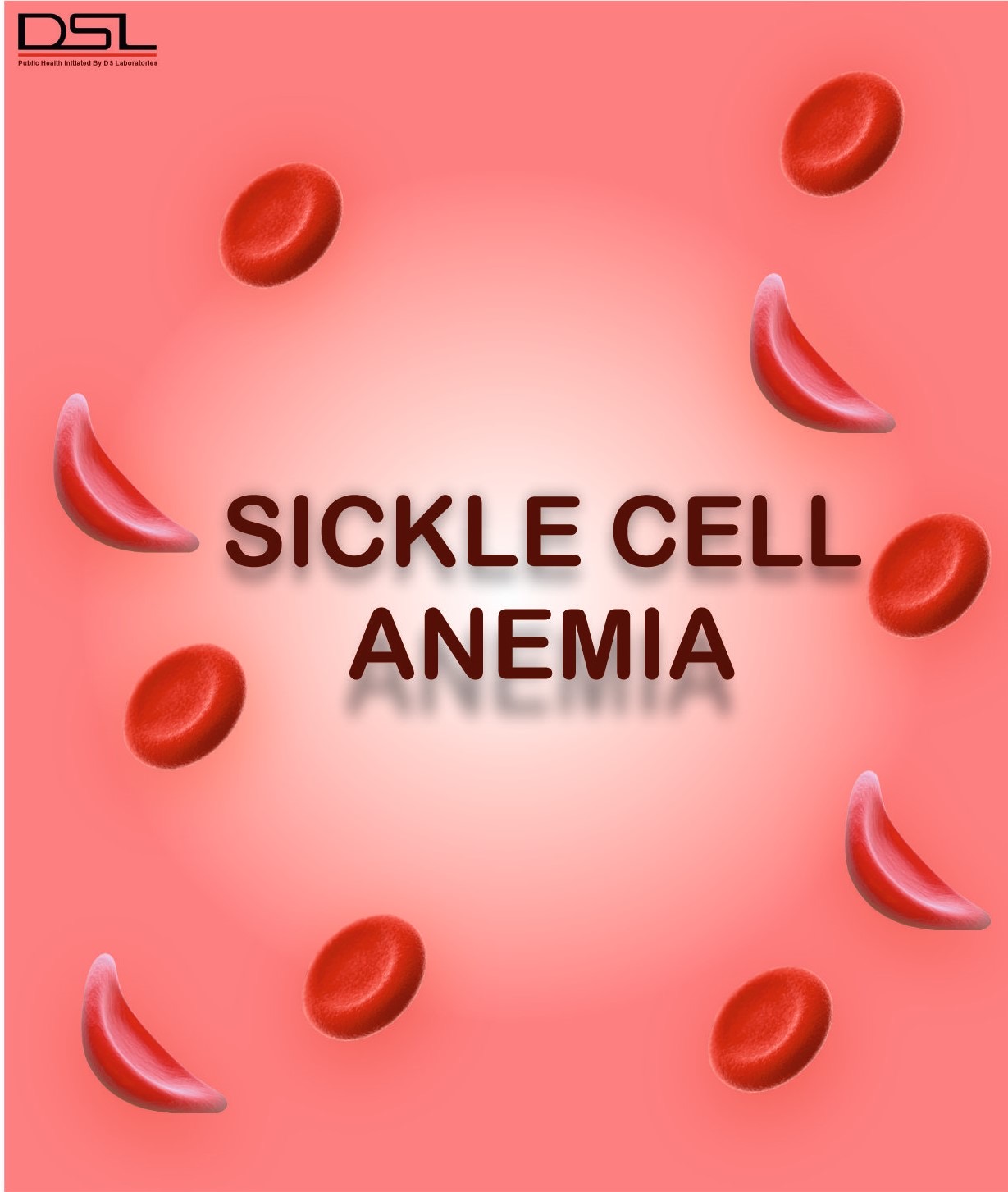 SICKLE CELL ANEMIA